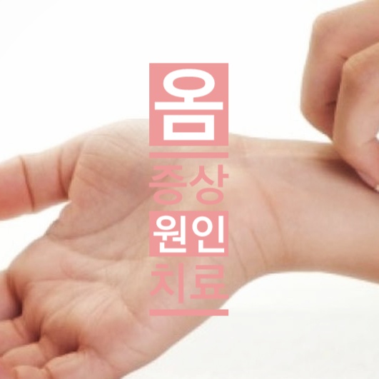 옴 이미지