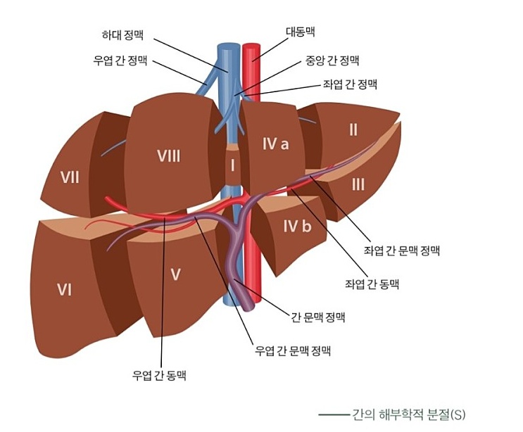 이제 간암 절제수술 5년이 되어 갑니다- 간암 재발은 어느경우에 많은가?