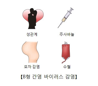 B형간염원인