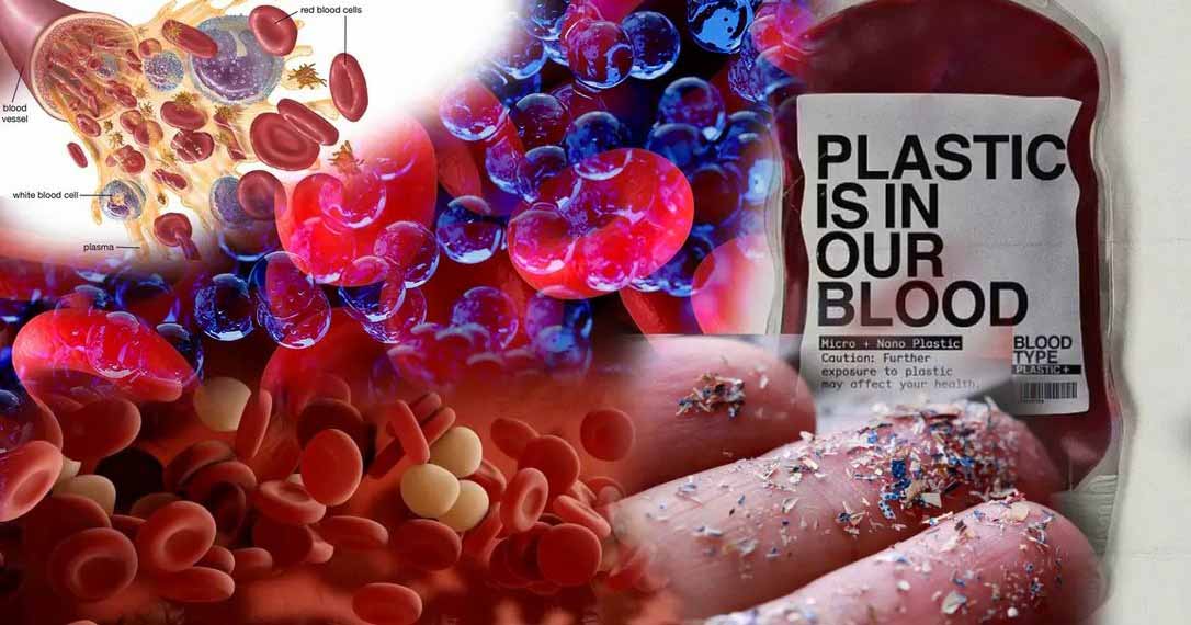 Dutch study found microplastics in blood