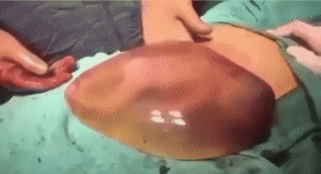  알에서 태어난 아기.gif