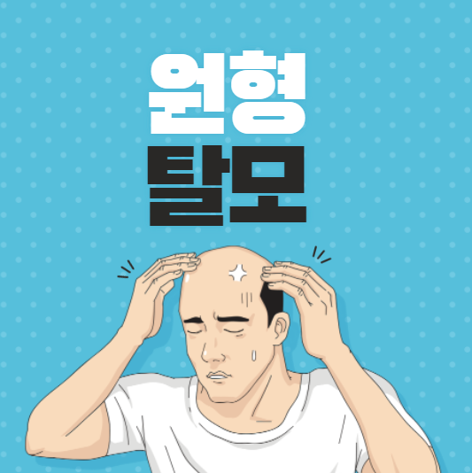  원형탈모의 원인과 증상 치료법