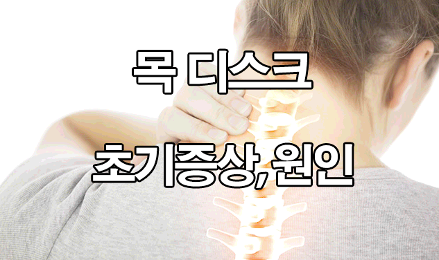  목 디스크 초기증상 및 원인 : 스트레칭, 치료