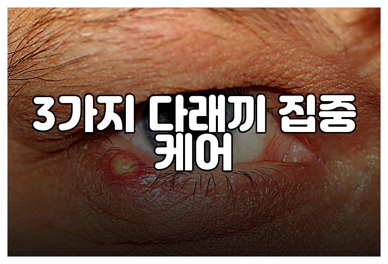 3가지 다래끼 집중 케어