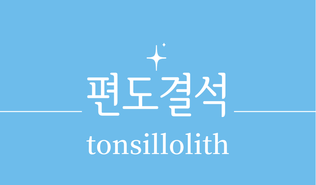 '편도결석(tonsillolith)'