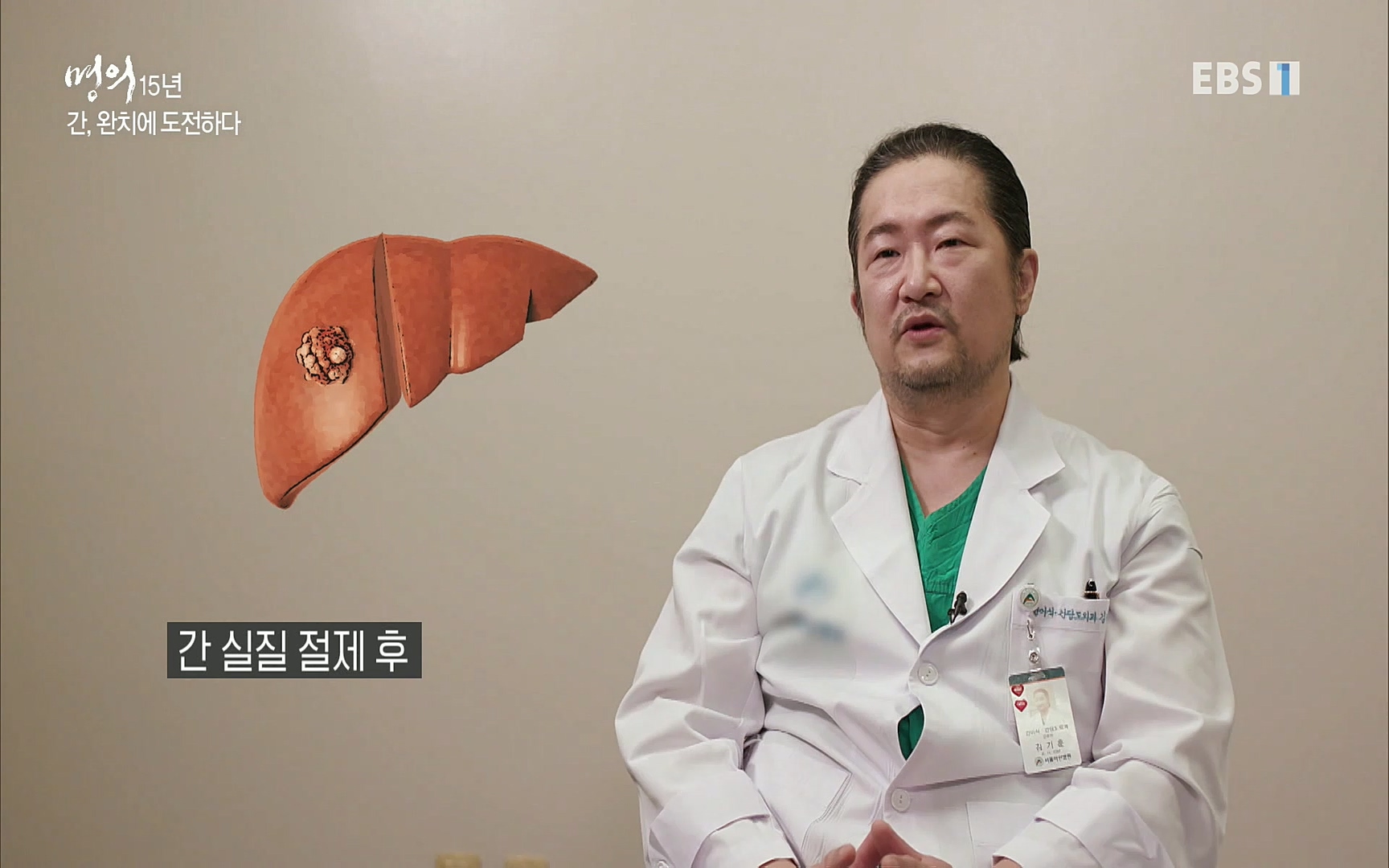 EBS 명의 헬스케어 - TV - 교육의 중심 EBS명의 15년 - 간, 완치에 도전하다.mp4_20220802_202425.991.jpg