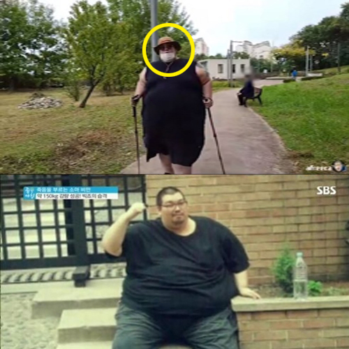  가수 빅죠 최근 몸무게 및 수술 중 사망 논란