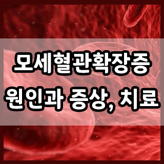  피부에 붉은 실 무늬, 모세혈관확장증의 증상과 원인
