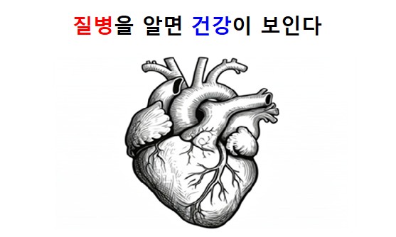 비ST분절 상승 심근경색