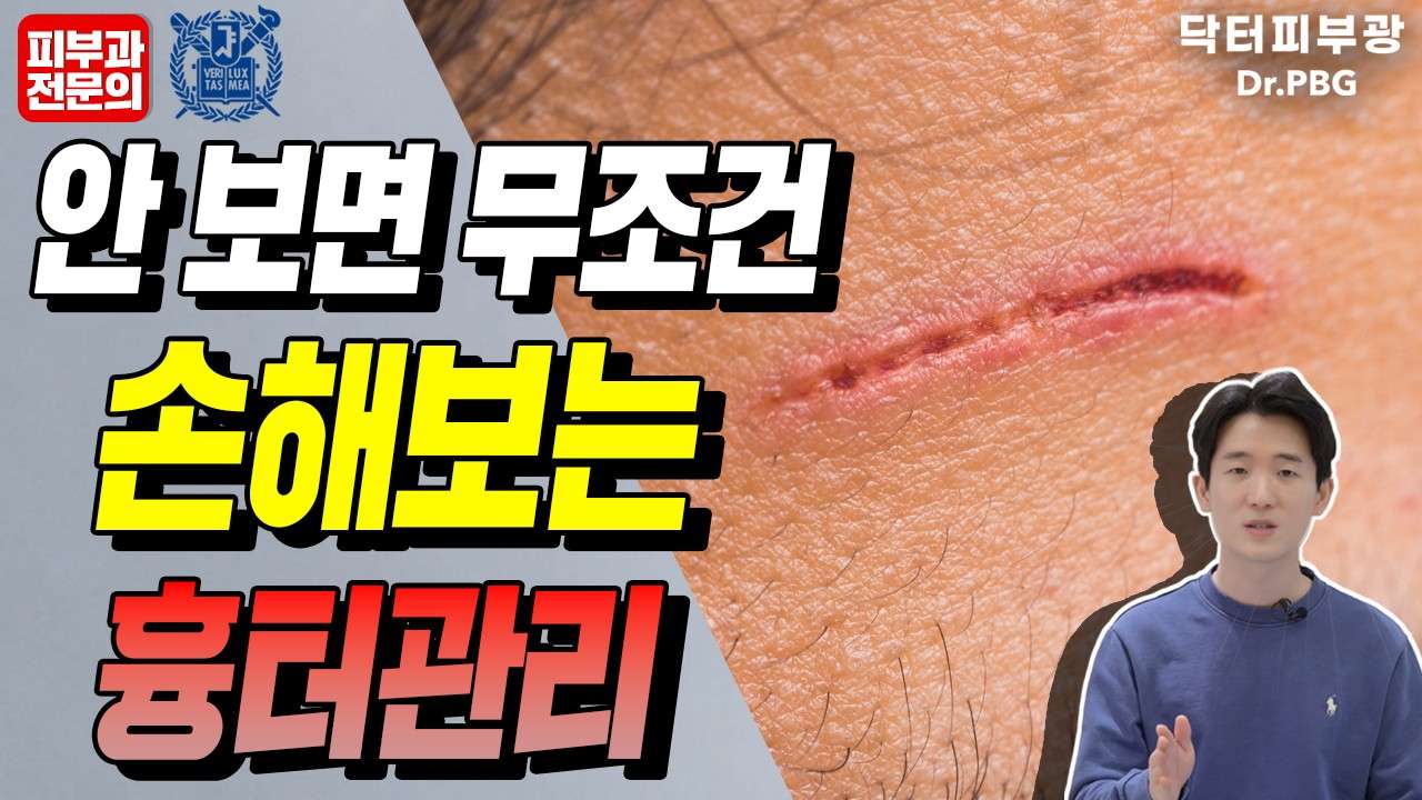  다쳤을 때 흉터 안 남는 상처 관리법의 정석을 알려드립니다