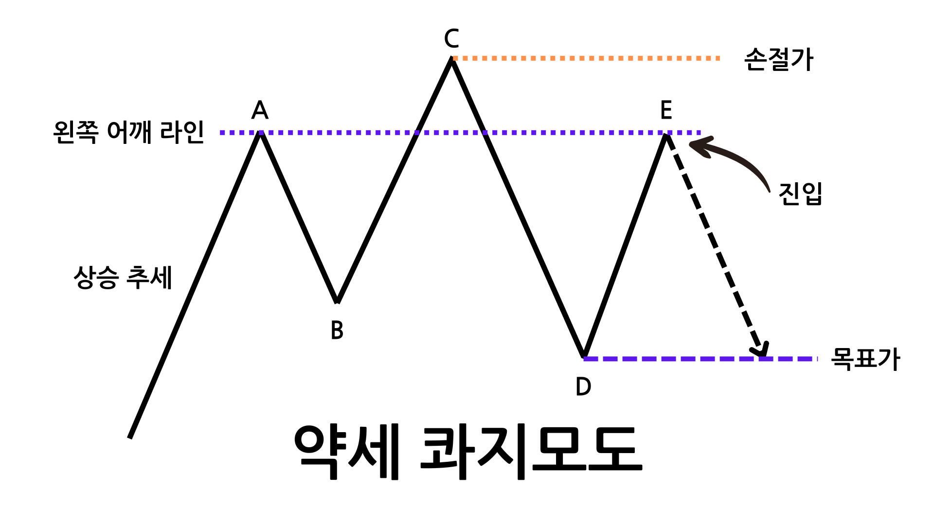 약세 콰지모도 패턴 모식도