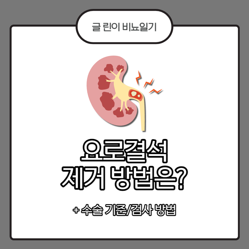  요로결석 제거 방법은?