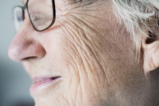 menopausal-symptoms