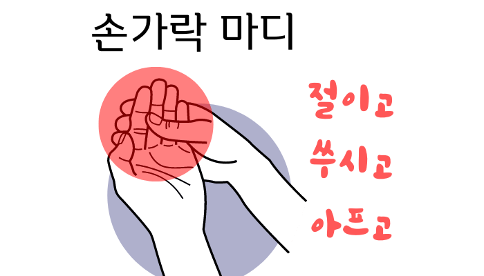 손가락 마디 통증과 치료-파스 찜질 효과있나?