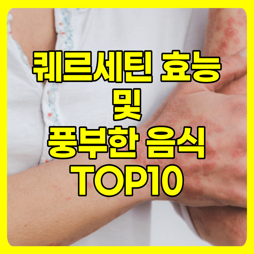  대마종자유 핵심성분 퀘르세틴 효능 및 풍부한 음식 TOP10