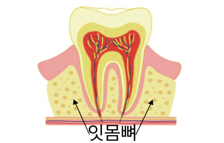 치아를-지탱하는-잇몸뼈