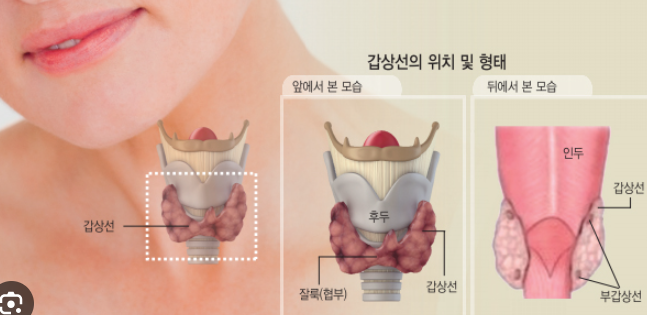 갑상선암, 진단과 치료