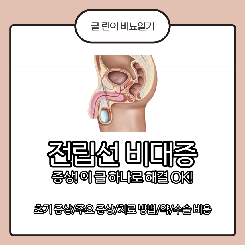  전립선 비대증 증상! 이 글 하나로 해결 OK!