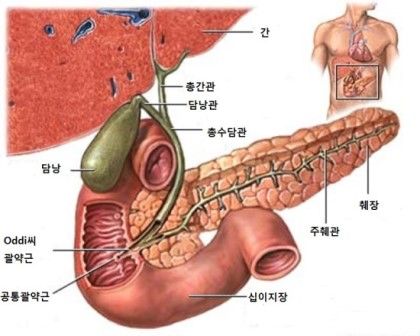 담낭염 증상