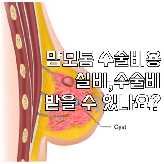 맘모톰 수술 후기/울산 중구 서경지유반외과/울산 여의사 유방외과 추천/맘모톰 수술 실비청구 13