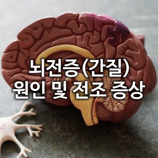 뇌전증(간질) 원인 및 전조 증상 알아보기