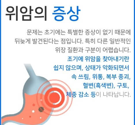 위암의 증상