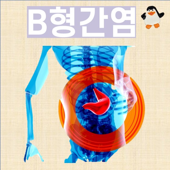 B형간염