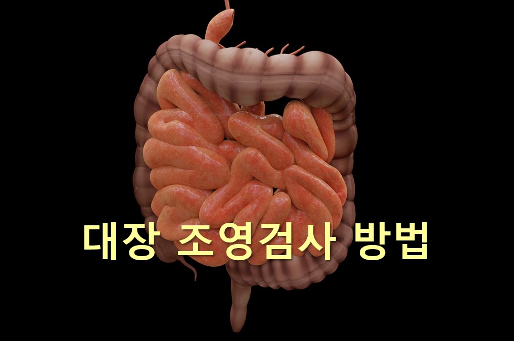  대장질환을 검사하는 대장 조영검사 방법