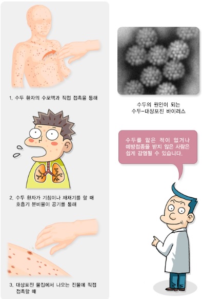 수두 감염 경로