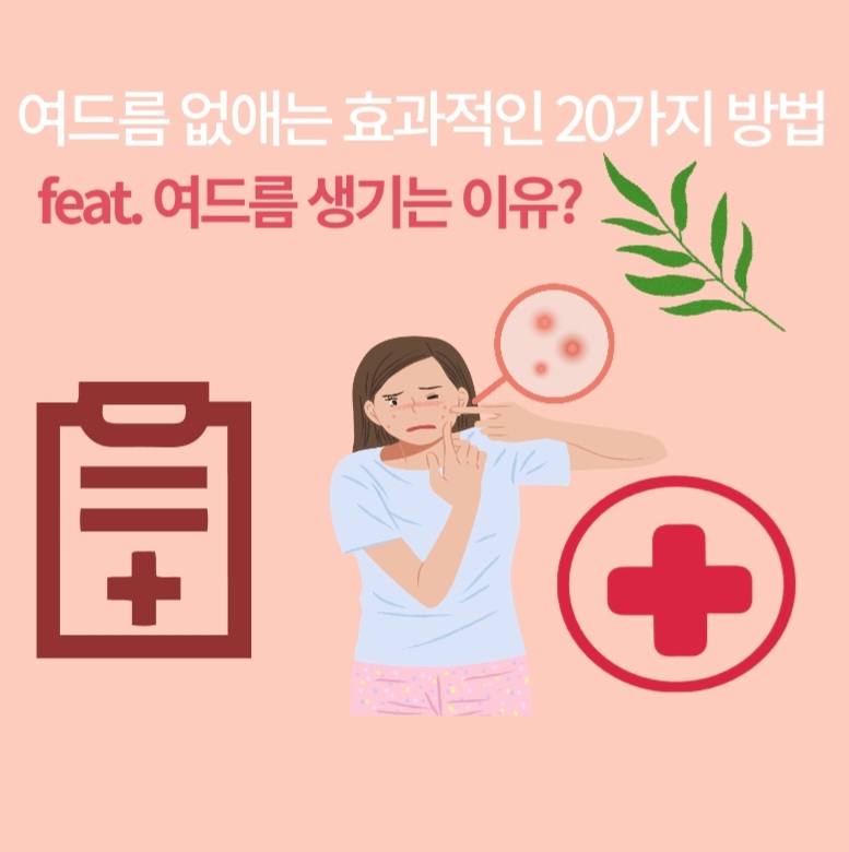  여드름 없애는 법? 효과적인 방법 20가지?feat.여드름 생기는 이유