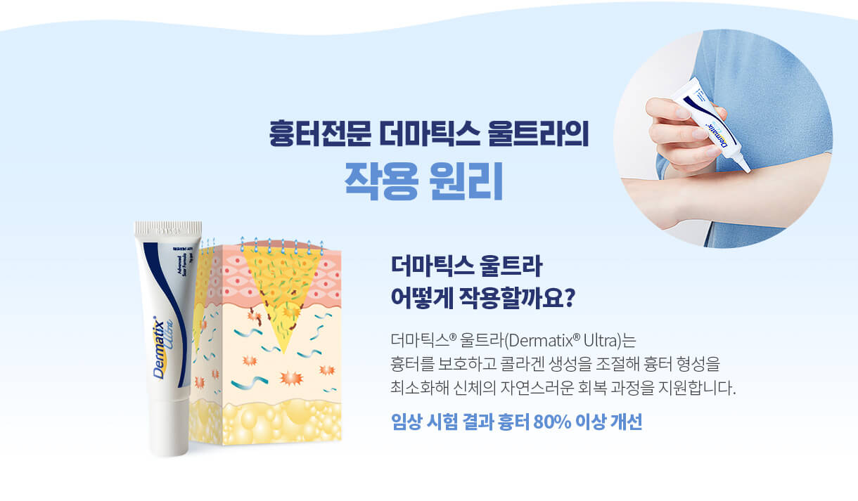 수술 켈로이드 흉터 연고