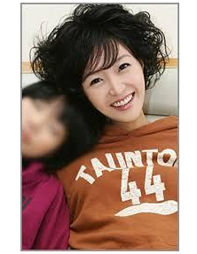 이의정 뇌종양 사건의 진실과 성형수술 입장