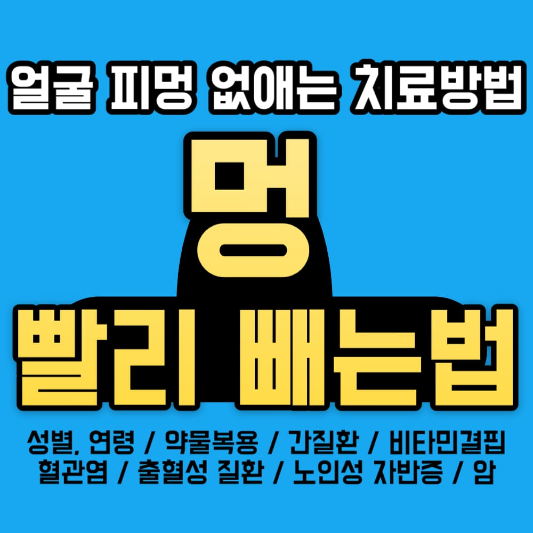 멍-빨리-빼는-법과-얼굴-피멍-없애는-치료방법