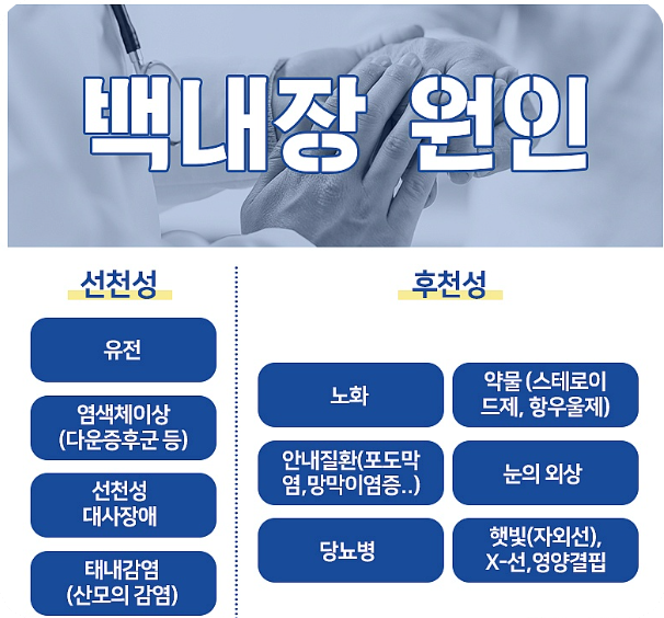 백내장실비후기3