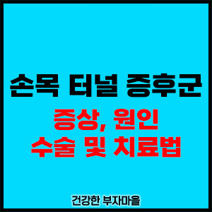 손목 터널 증후군