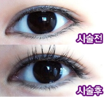  속눈썹 이식 전후 비교 및 장점과 부작용