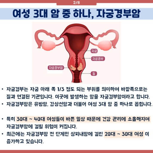 자궁경부암