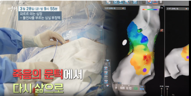 명의 심장 심실부정맥