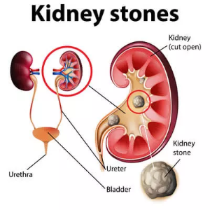 kidneys_zoom_in