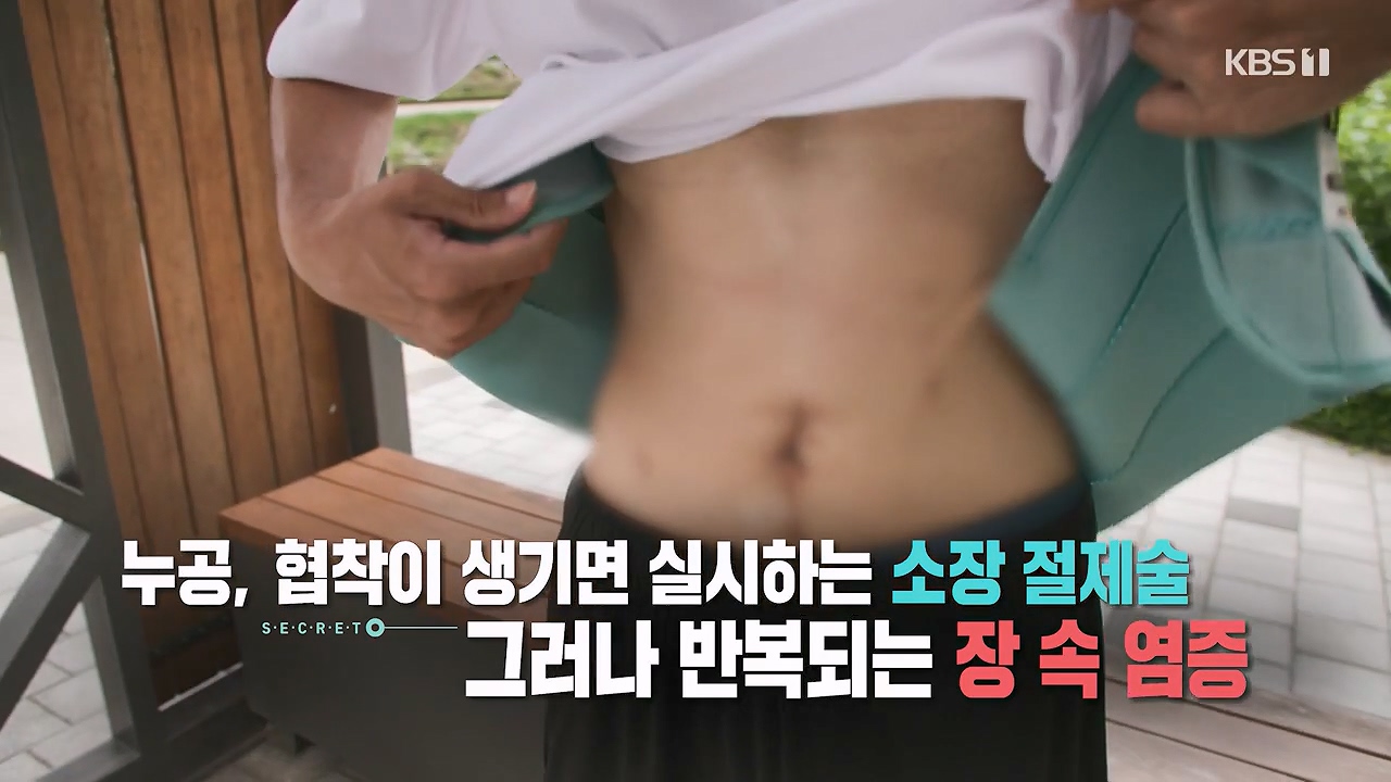 생로병사의 비밀.E884.230921p-NEXT.mp4_20230921_202810.838.jpg