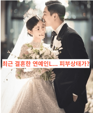  최근 결혼한 연예인L... 피부상태가?