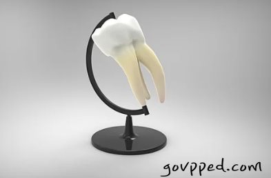  임플란트 가격