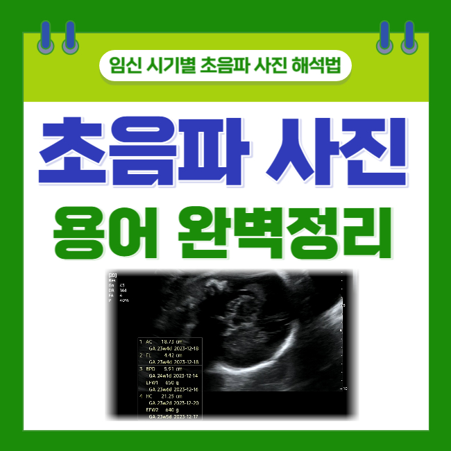  임신 시기별 초음파 사진 해석법; 초기/중기 초음파 용어(영어) 완벽정리