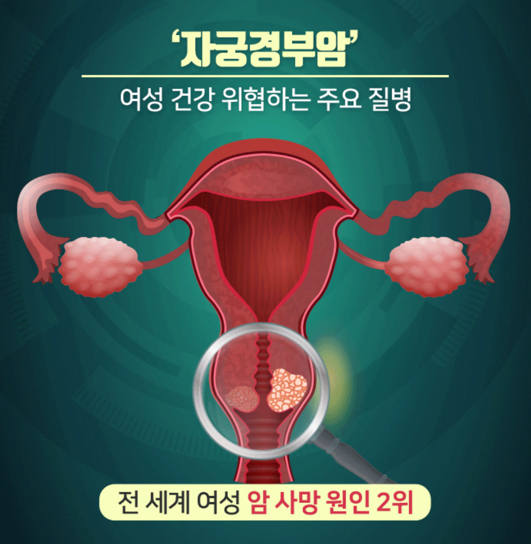 자궁경부암 검사방법 자궁경부암 검사비용