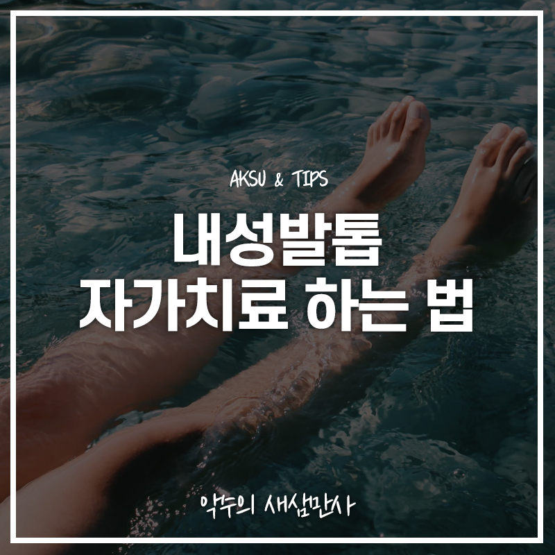  내성발톱 자가치료 가능할까? 내성발톱 이겨내는 법