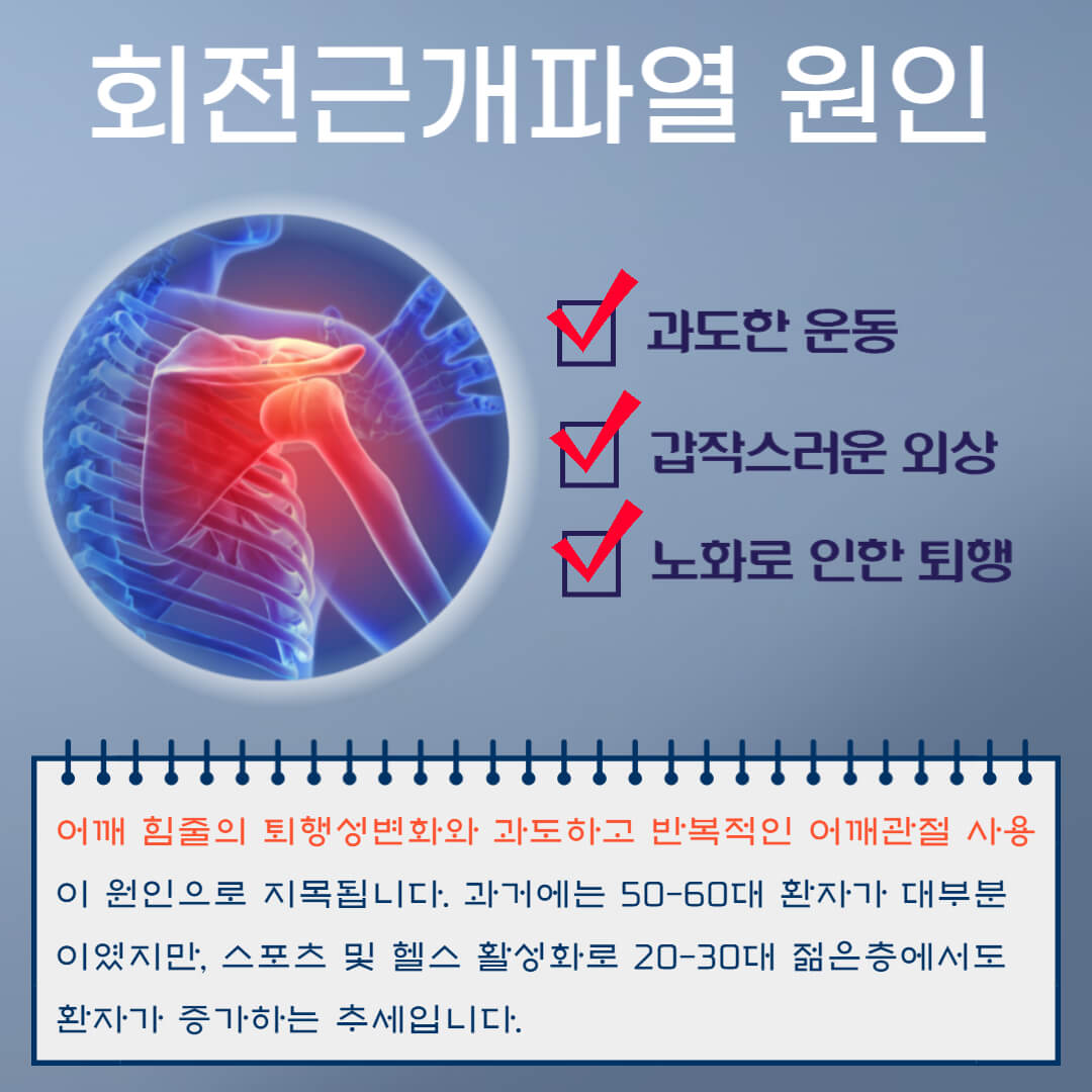 회전근개파열 원인