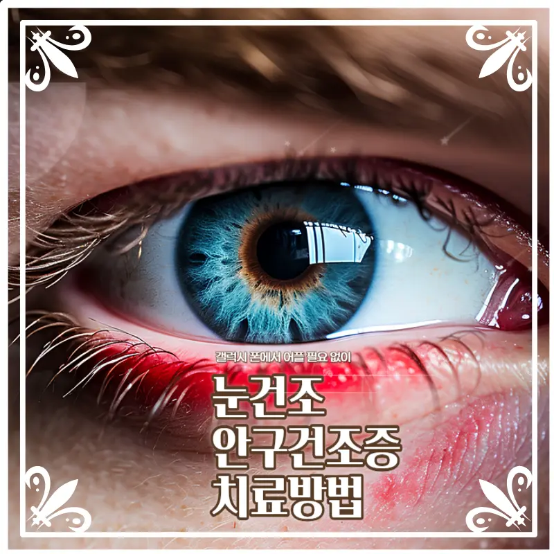 눈건조 안구건조증