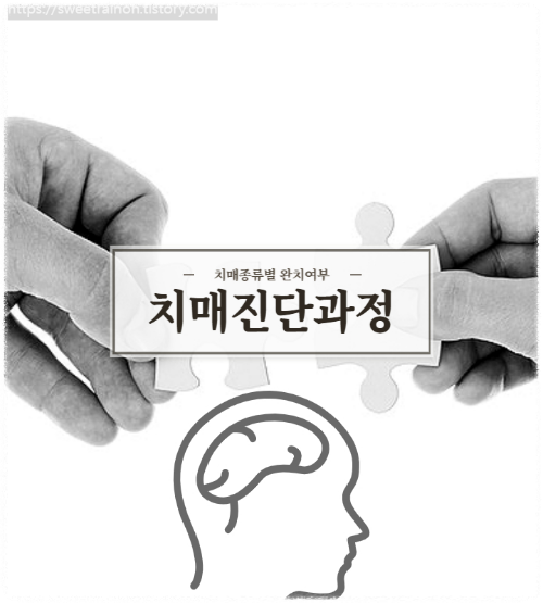 퍼즐과-뇌-일러스트