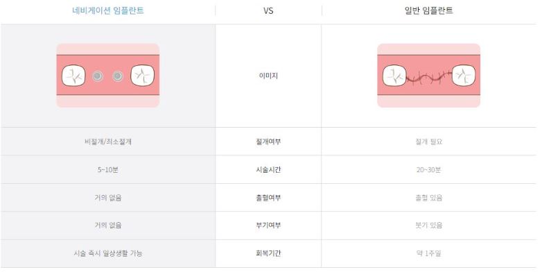 임플란트-시술-방식