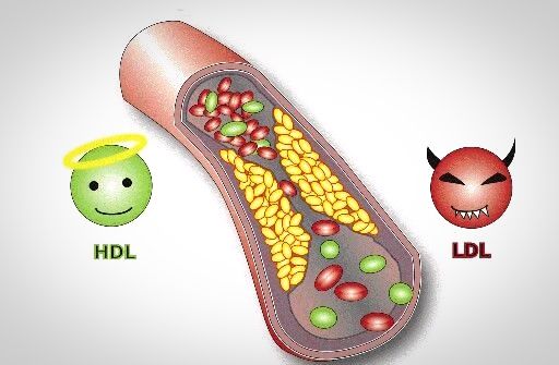 저밀도 콜레스테롤 이란